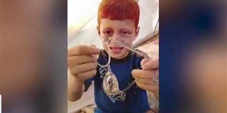 والد الطفل أيوب: اللجنة المصرية أعادت البسمة لابني بعد توفير نظارة جديدة - أقرأ 24