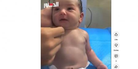 نظرته تخطف القلب.. صغير يرى بعينه للمرة الأولى منذ ولادته (فيديو) - أقرأ 24