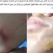القبض على طالب تعدى على زميله بقطعة زجاج بالبحيرة - أقرأ 24