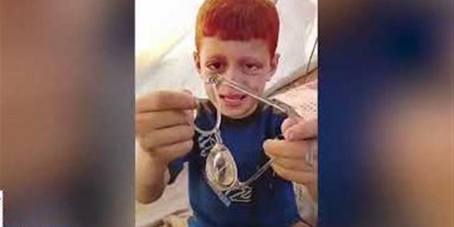 والد الطفل أيوب: اللجنة المصرية أعادت البسمة لابني بعد توفير نظارة جديدة - أقرأ 24
