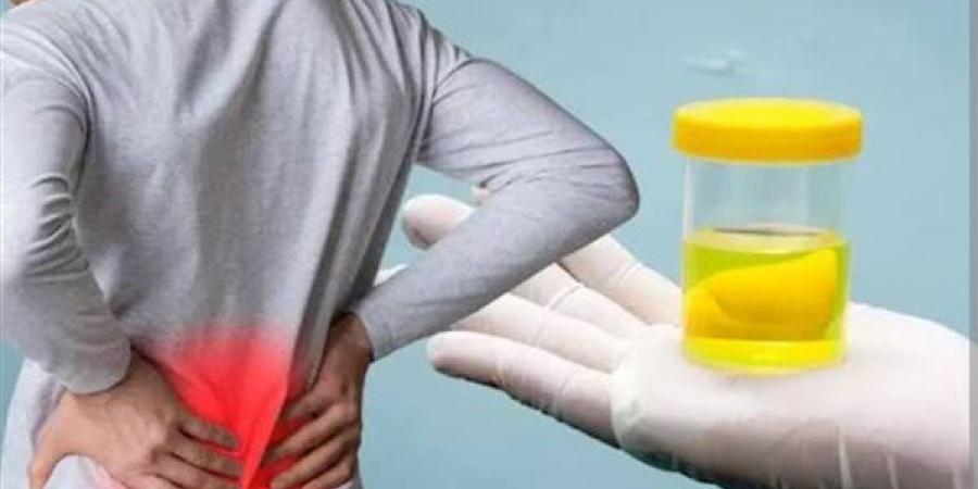 لون البول في الصباح.. ماذا يخبرك عن حالة جسمك؟ - أقرأ 24