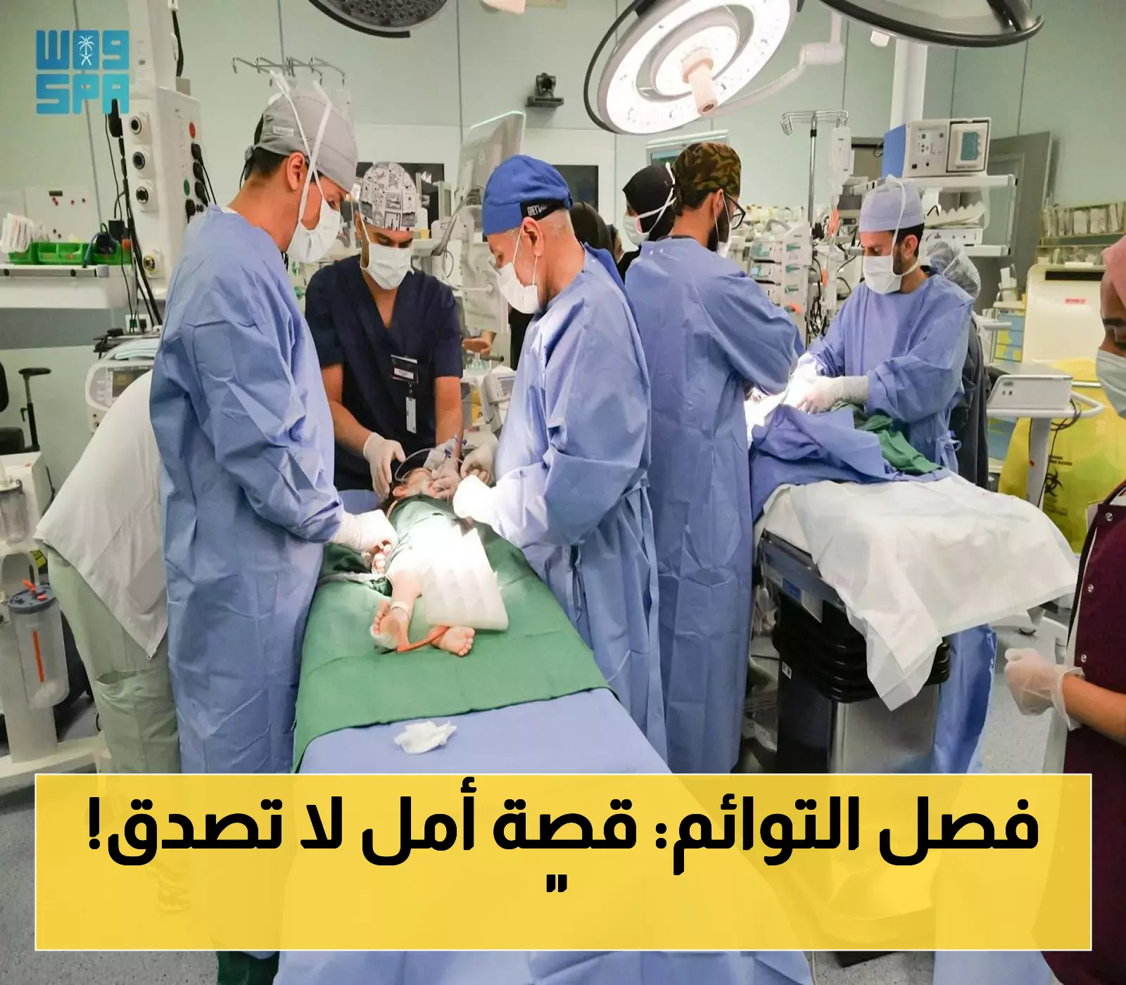 «إنجاز طبي تاريخي» البرنامج السعودي يفصل التوأم السيامي السوري “سيلين وإيلين” في عملية معقدة تمنح عائلة لاجئة أملاً جديداً