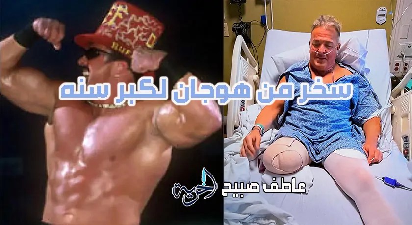«نهاية مأساوية» بتر ساق نجم المصارعة باف باجويل بعد صراع دام 5 سنوات مع مضاعفات صحية