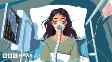 «من الظلام إلى النور» ناجٍ من الغيبوبة يكشف تفاصيل تجربته المروعة