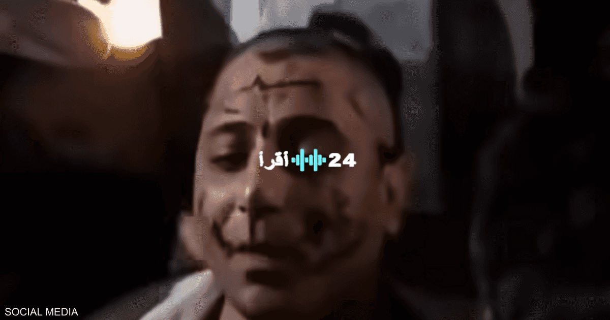 «صدمة في الوسط الفني».. اعتداء يطال مطرباً سورياً شهيراً في حلب.. أول رد رسمي يكشف التفاصيل