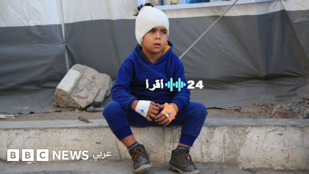 «استجابة إنسانية عاجلة» المملكة المتحدة تفتح أبوابها لأطفال غزة الجرحى للعلاج قريبا