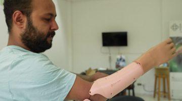 «إنجاز طبي واعد».. تونس تطلق ثورة الأطراف الصناعية بتقنيات الذكاء الاصطناعي والطباعة ثلاثية الأبعاد
