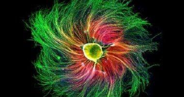 أغرب 7 جوائز في العالم ستذهلك تفاصيلها